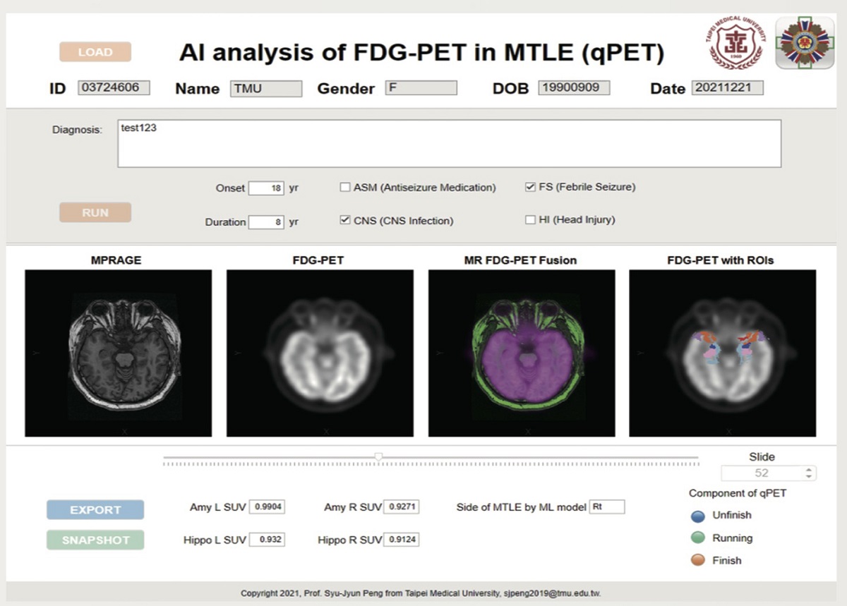 彭徐鈞所建構的qPET平台，能幫助醫師評估醫學影像、診斷疾病，並可針對感興趣的腦區生成AI分析報告